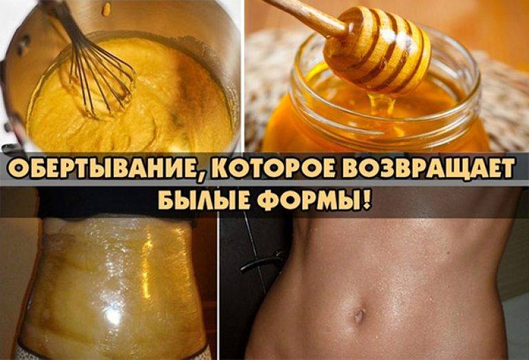 Противопоказания при миоме матки - что нельзя делать.